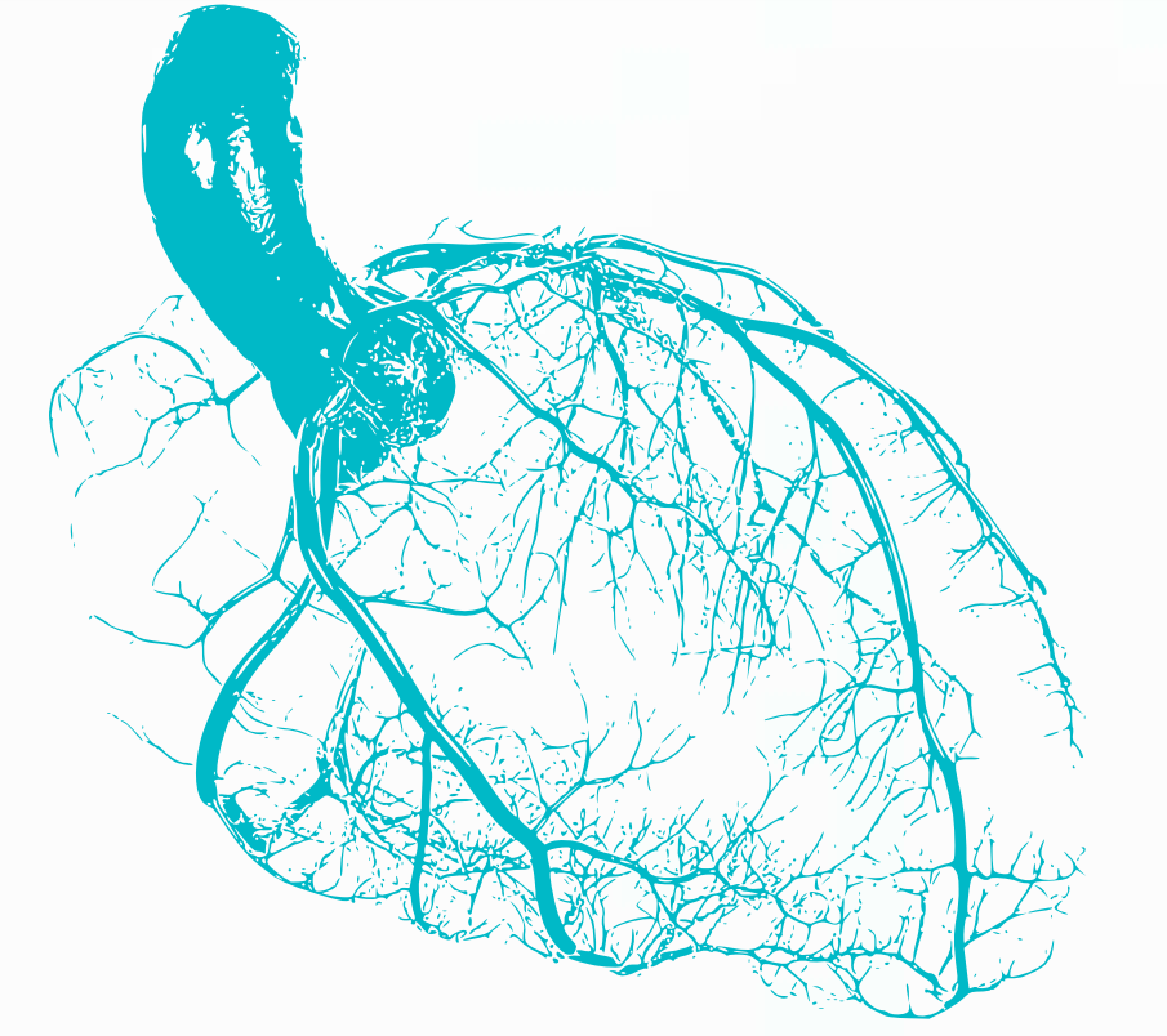 Endovascular product