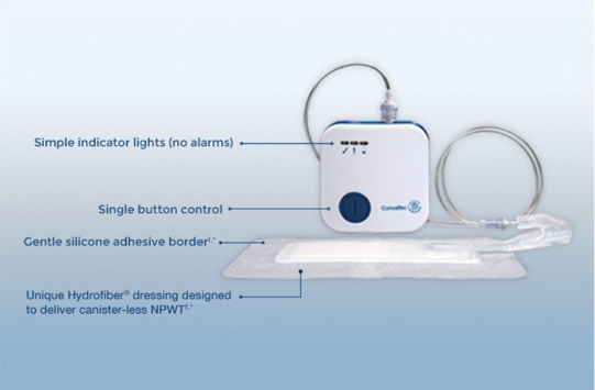 AVELLE Negative Pressure Wound Therapy System