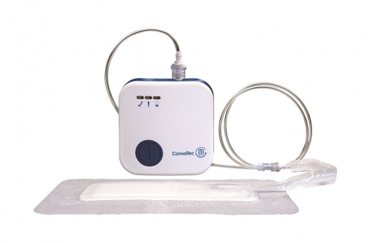 AVELLE Negative Pressure Wound Therapy System